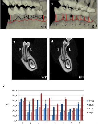 RANK/RANKL/OPG Signalization Implication in Periodontitis: New Evidence from a RANK Transgenic Mouse Model